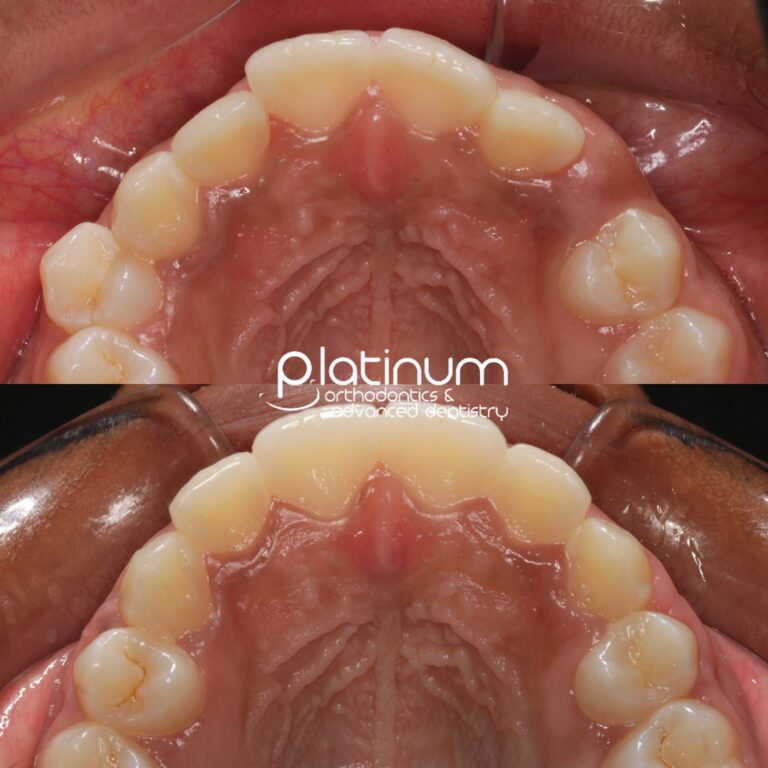 461285196 955276236613818 7070051000936078776 n 768x768