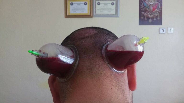 462589209 4262570150656579 5424029602936294750 n 768x431