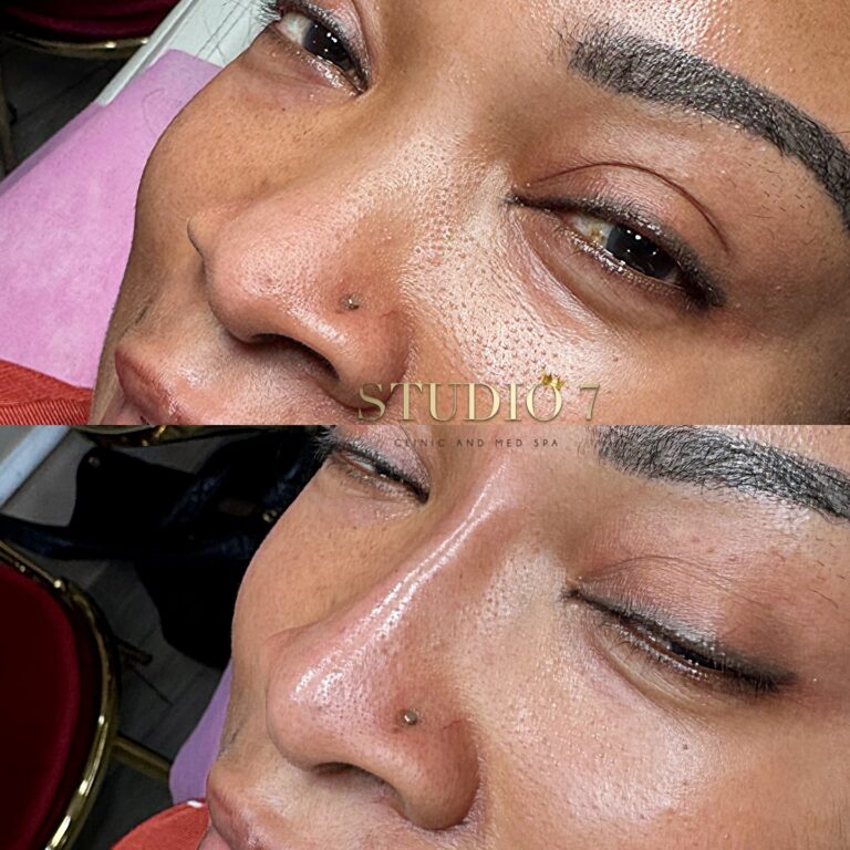 462693298 18106881160429258 7115834521793313708 n 768x768