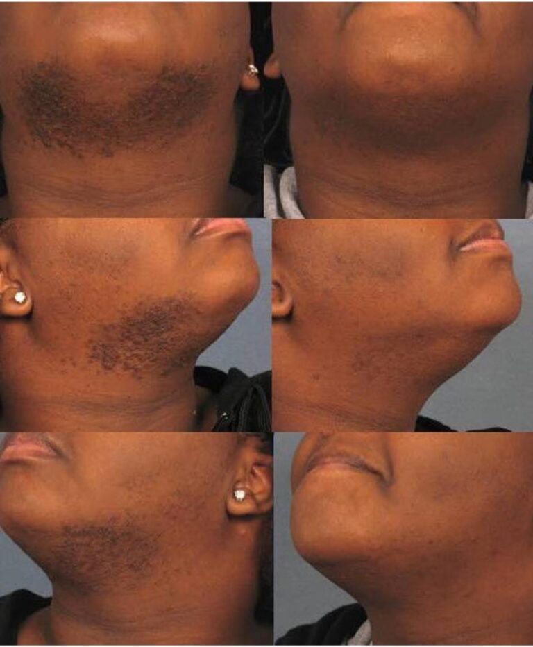 56588496 2082882798497451 6246687575893868544 n 768x932