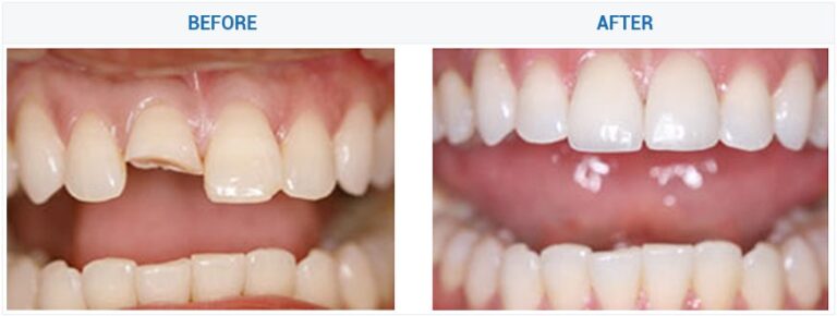 81876398 128951058589304 5864875613323526144 n 768x290