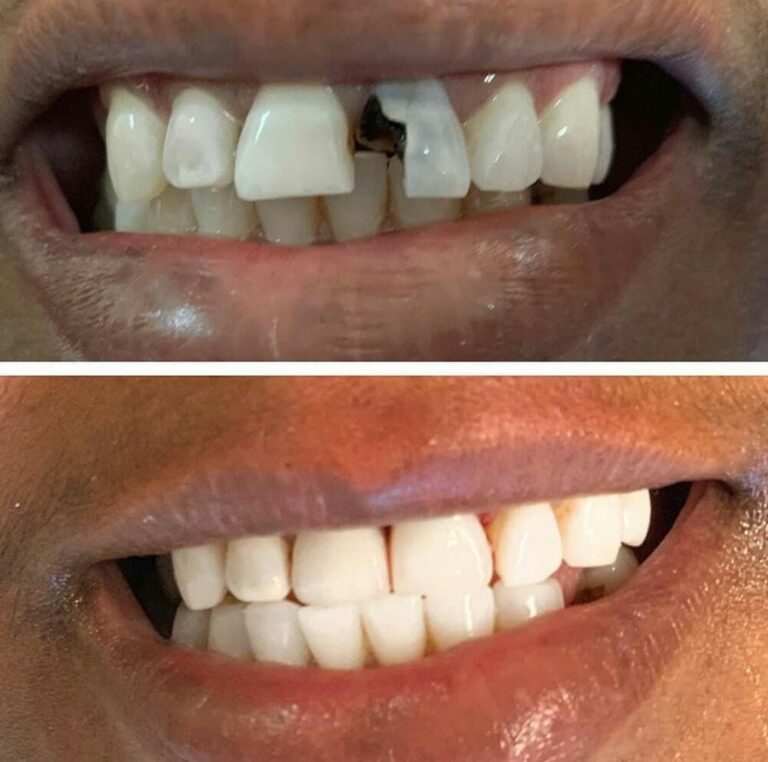 100472494 2582799228641116 6378074856021295104 n 768x762