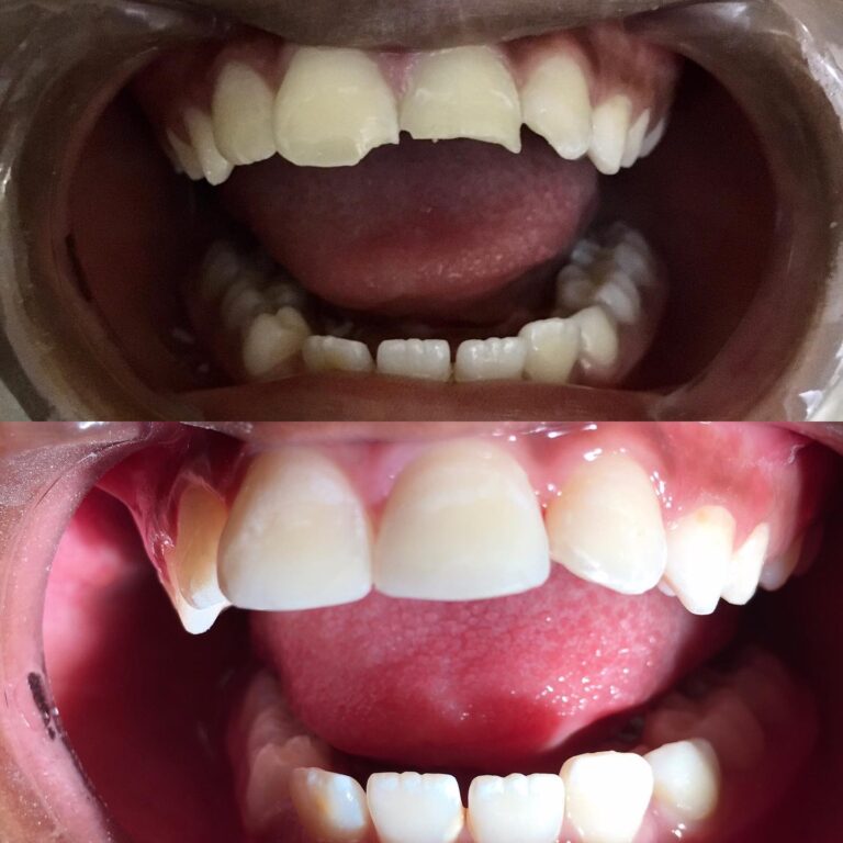 120121142 3290205554361811 8696070559649462524 n 768x768