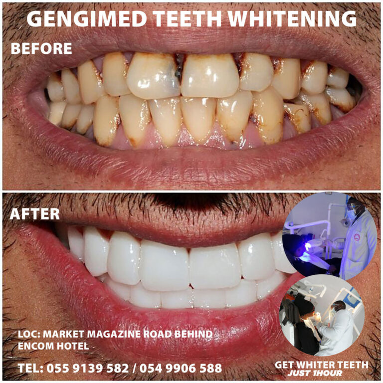 163814062 100173955509631 4710044776145621653 n 768x768