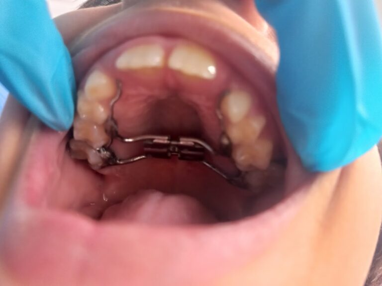 20220423 151434 768x576