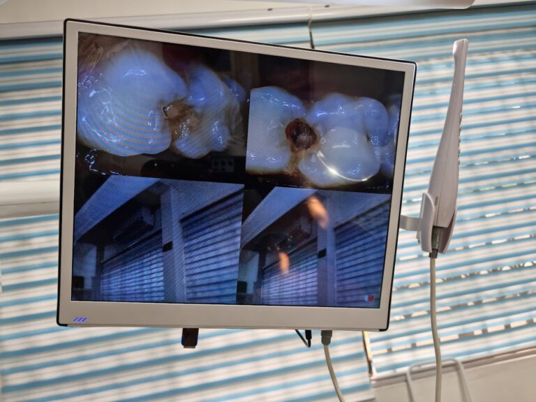 20220829 075809 768x576