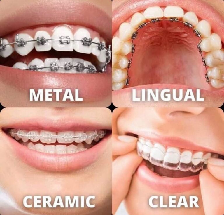 271813011 314083677302968 3361530272816818009 n 768x740