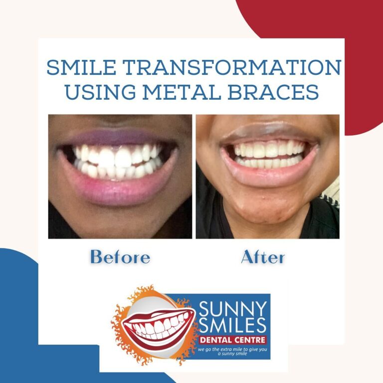 278858441 4958898324159184 4616242498778819681 n 768x768