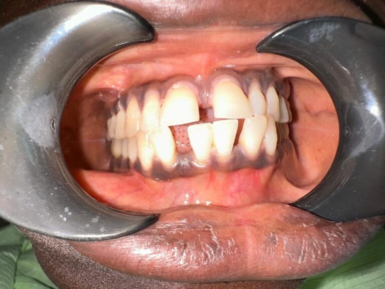 340344666 1706969349761203 4775504128487201405 n 768x576