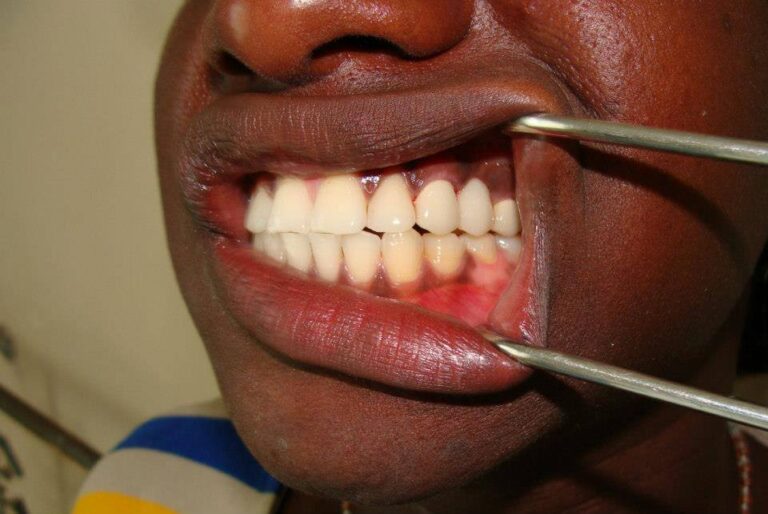 463008222 8455837481168076 2112170597401961004 n 768x514