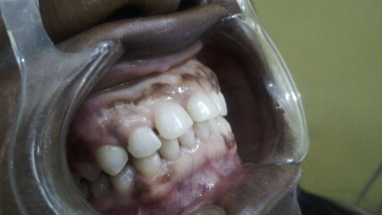 463254181 8509939172388397 4948593283964825205 n 768x432