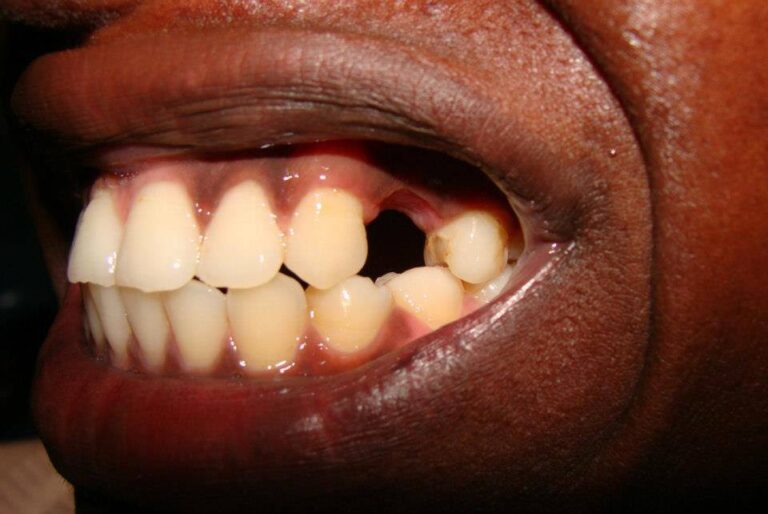 463297018 8455837477834743 4127796870763774181 n 768x514