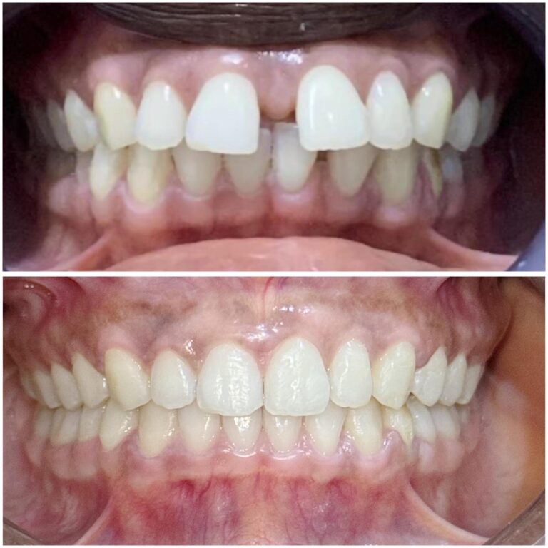 463338289 975526727945651 3220147801850194784 n 768x768