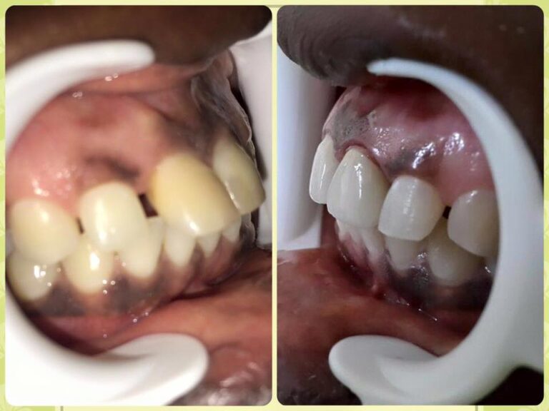 464432900 8518020491616441 4755028059055524110 n 768x576