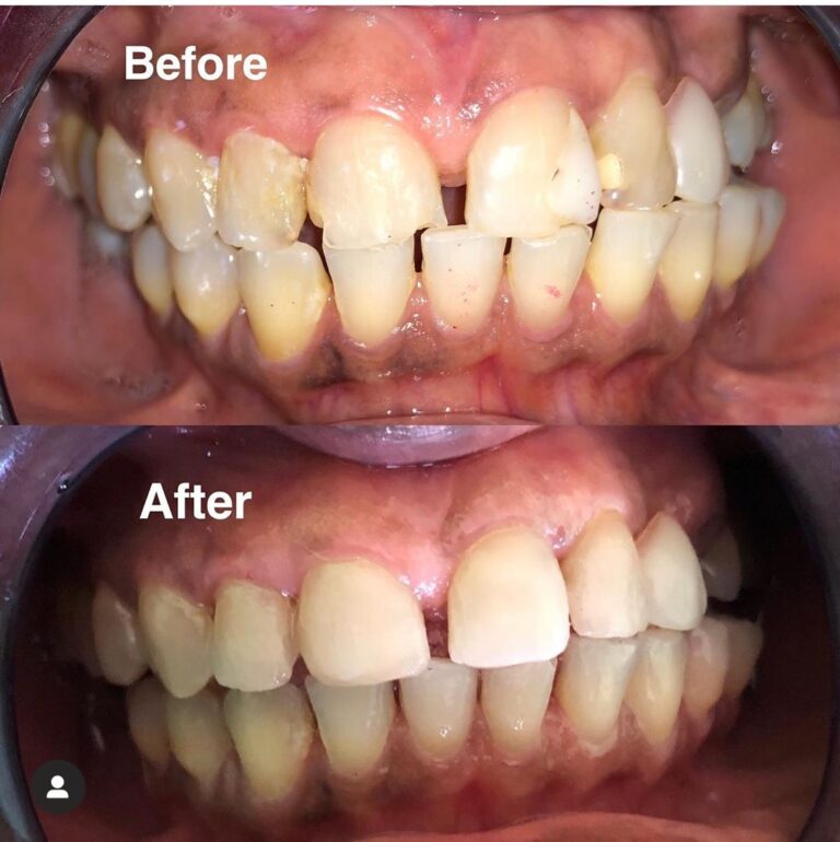 64814635 479162366151927 559604839617658880 n 768x770