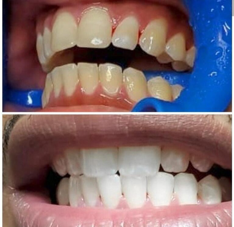 99420884 2582801095307596 4337763501188579328 n 768x748