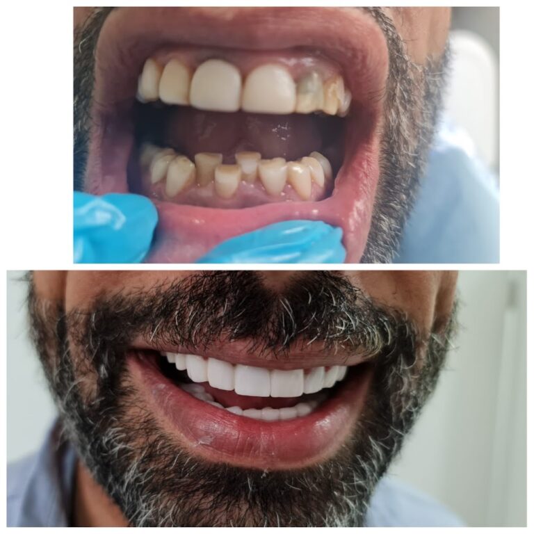 IMG 20220519 WA0027 768x768