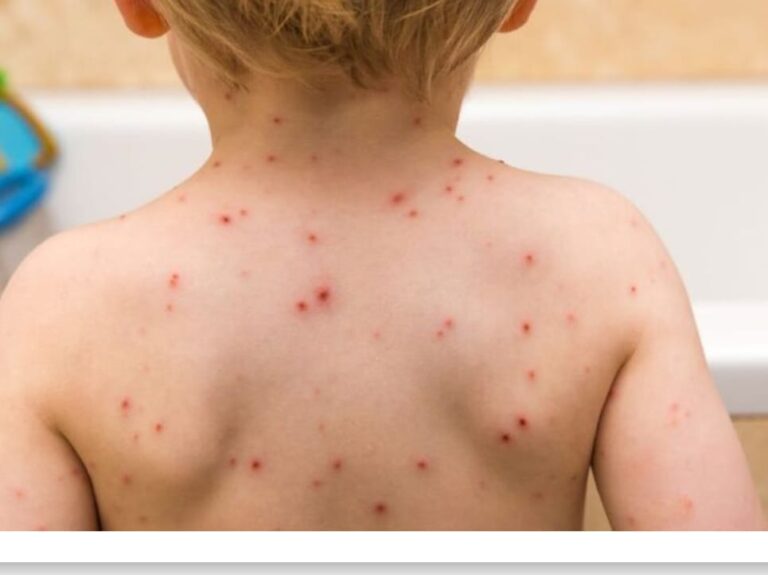 WhatsApp Image 2024 03 03 at 22.42.49 caff41f5 768x575